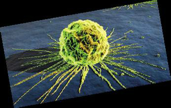 癌症幹細胞