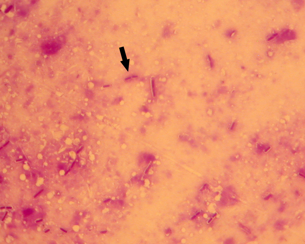 產氣莢膜梭菌形態 革蘭染色，X1000