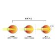 屈光不正(屈光異常) 屈光不正(屈光異常)