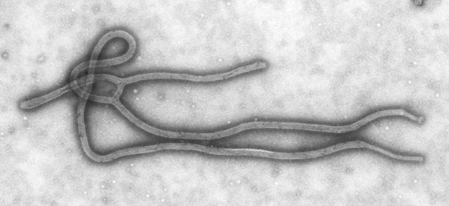 電子顯微鏡下的伊波拉病毒結構