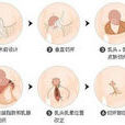 巨乳縮小 巨乳縮小