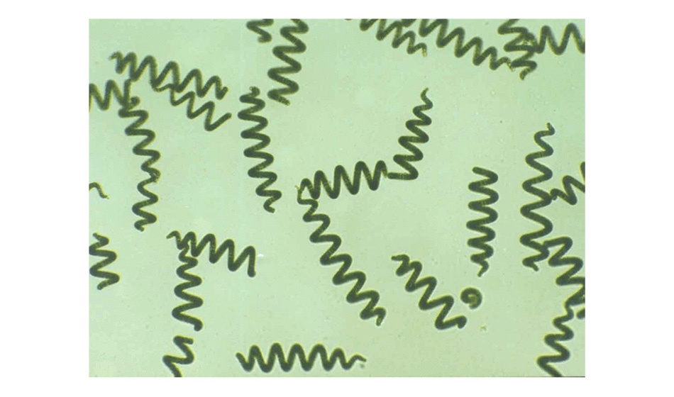 低倍顯微鏡下的螺旋藻