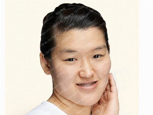 白曉琴 白曉琴