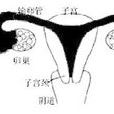 輸卵管腫瘤 輸卵管腫瘤