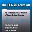 The ECG in Acute MI The ECG in Acute MI