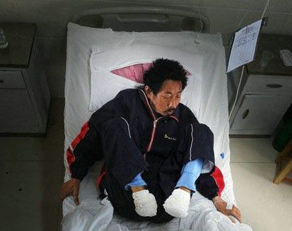 自斷病腳 自斷病腳