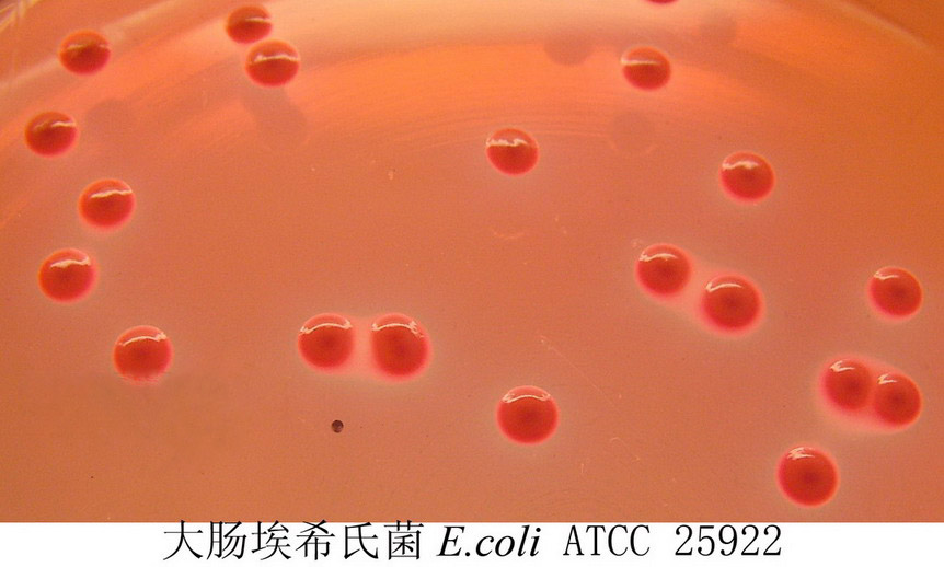 大腸埃希氏菌在培養基上顯示紅色