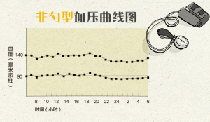 非勺型血壓