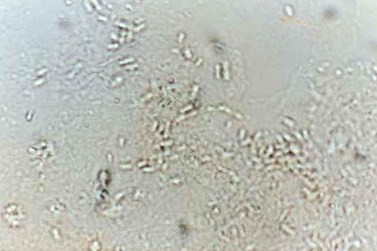 絲孢綱真菌