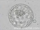 囊胚細胞核