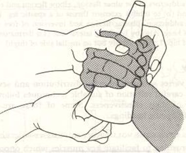 抑制腕和手指屈肌痙攣的方法