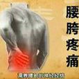 腰胯疼痛 腰胯疼痛