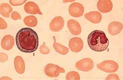 紅細胞分布寬度
