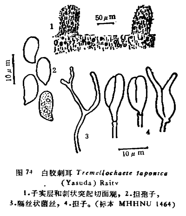 白膠刺耳 白膠刺耳