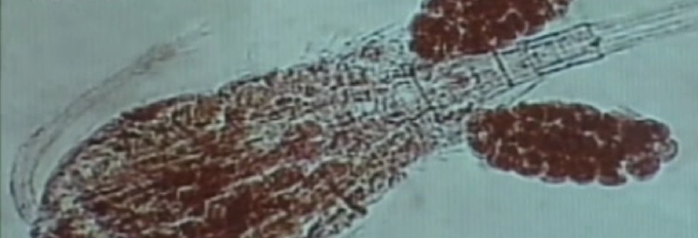 顯微鏡下的劍水蚤