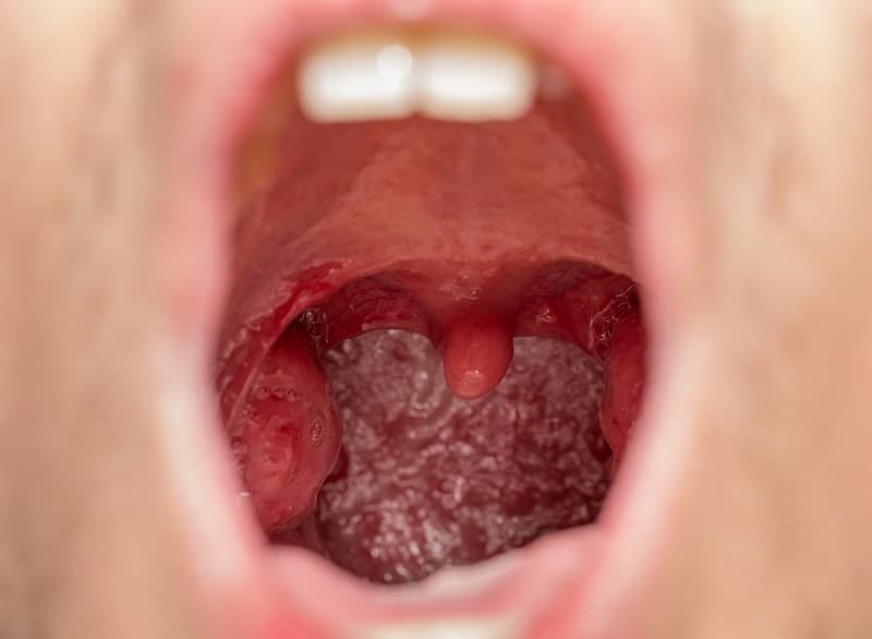 口咽