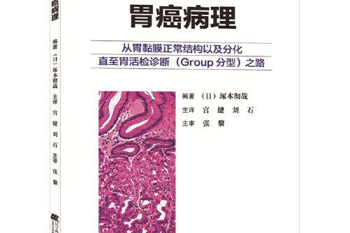 胃癌病理 胃癌病理