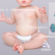 手足口病(手足口)