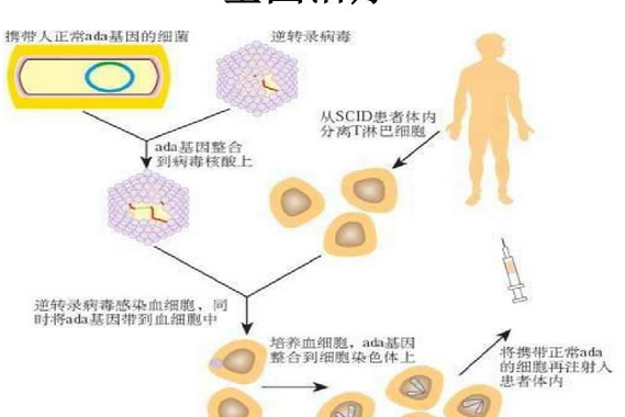 基因療法 基因療法