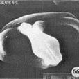 滇藏梨果寄生 滇藏梨果寄生
