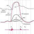 奔馬律 奔馬律