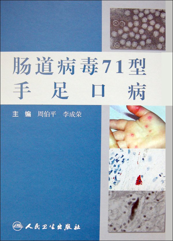 腸道病毒71型