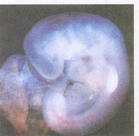 胚胎融合