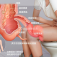 克羅恩病(克隆氏症)