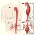 主動性充血 主動性充血