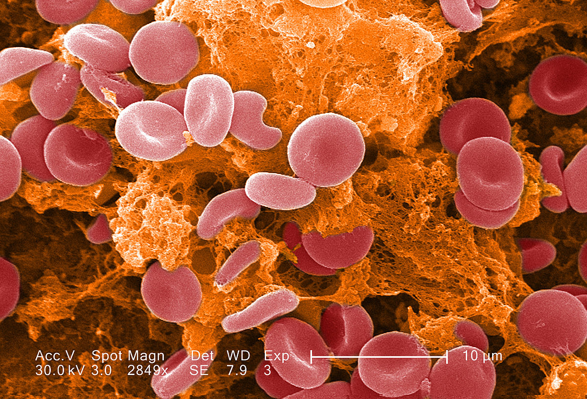 紅細胞基質