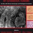 Reflectance Confocal Microscopy of Cutaneous Tumors Reflectance Confocal Microscopy of Cutaneous Tumors