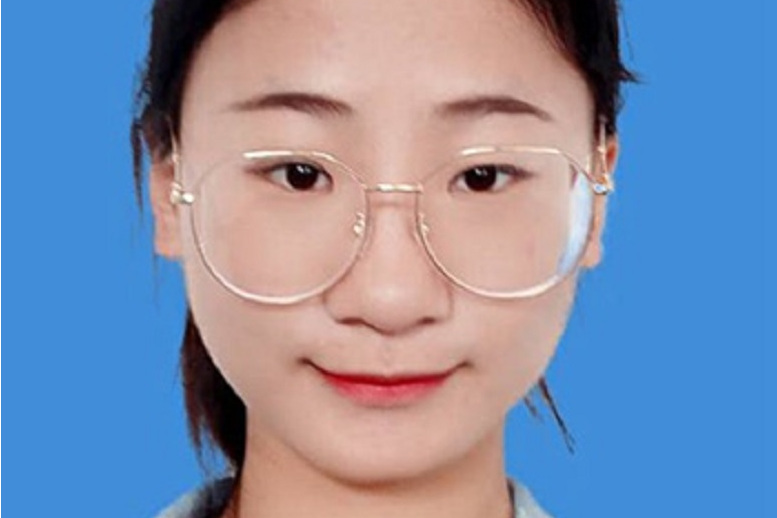 張舒昕 張舒昕