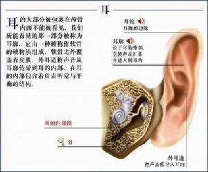 功能性耳聾