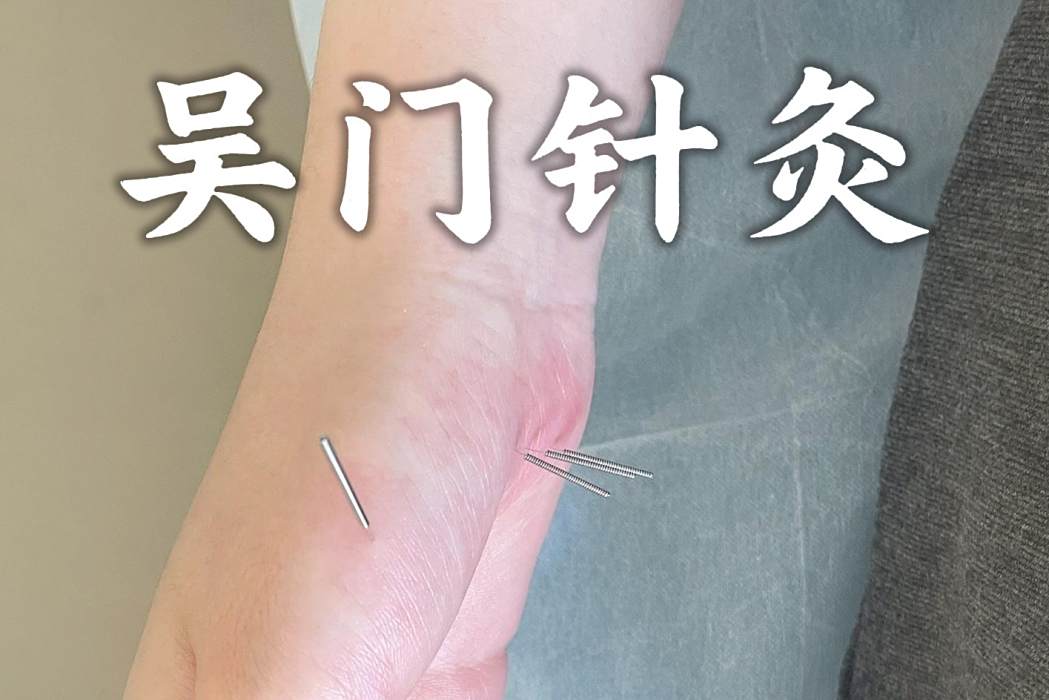 吳門針灸