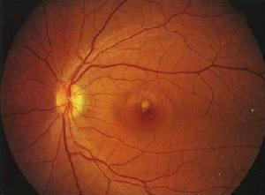 視網膜動脈