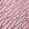 表皮系統(動物表皮(animal epidermis)) 表皮系統(動物表皮(animal epidermis))