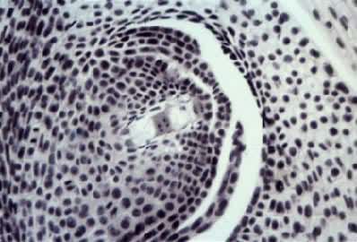 胚囊