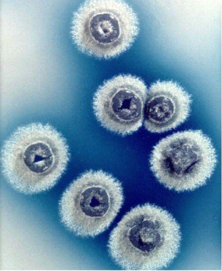 團孢鏈黴菌