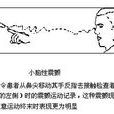 動作性震顫 動作性震顫