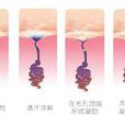 抑汗香體 抑汗香體