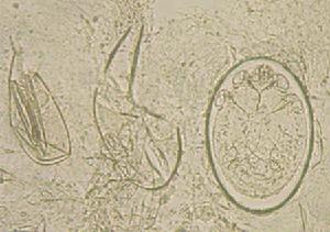 顯微鏡下的成年疥蟲