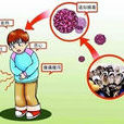 12·25廣州81名學生諾如病毒感染事件