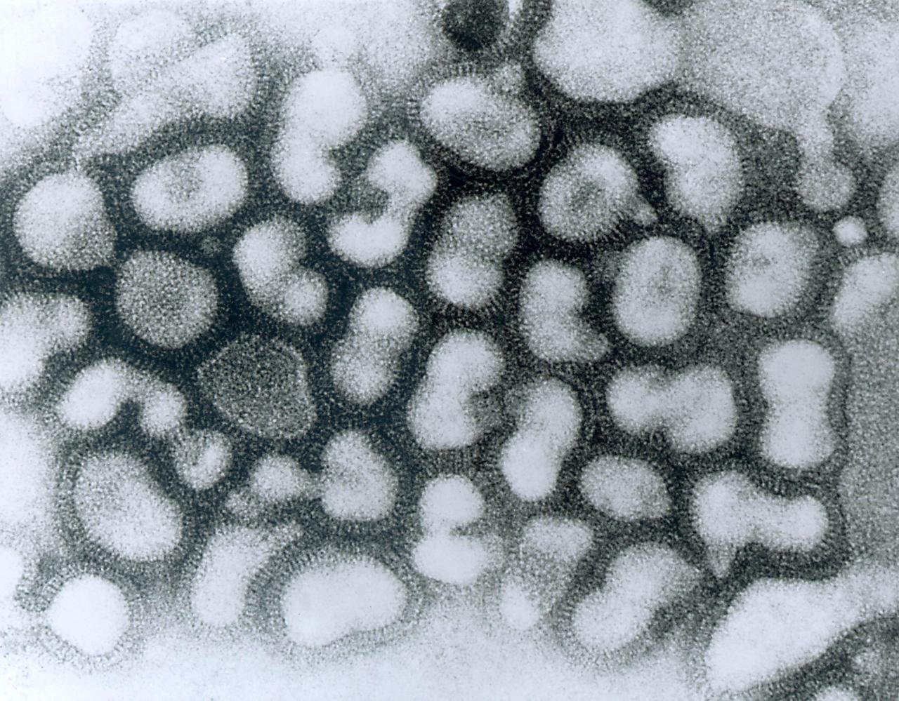 電子顯微鏡下的甲型流感病毒