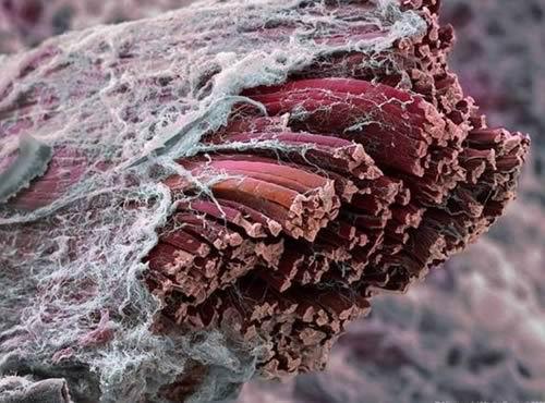 顯微鏡下的肌肉纖維