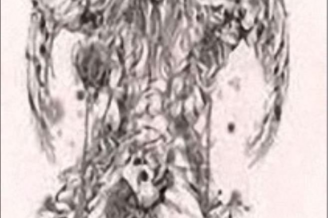 心理醫生(橘越良所著小說) 心理醫生(橘越良所著小說)