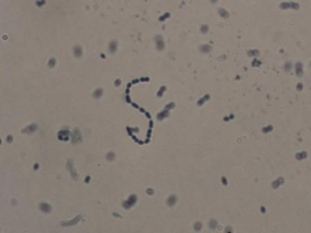 腸膜明串珠菌