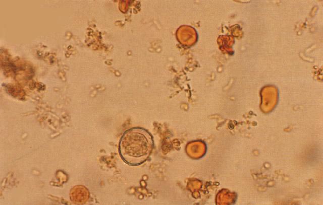 剛地弓形蟲成熟、未成熟卵囊和紅細胞