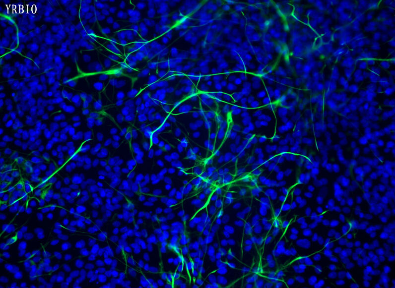 人神經幹細胞