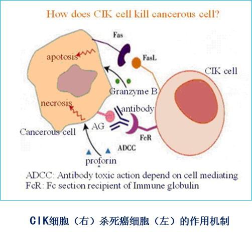 CIK細胞
