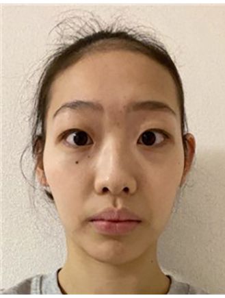 NISHIYAMA Saya NISHIYAMA Saya